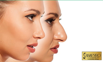 عملية تصغير الأنف في مصر
